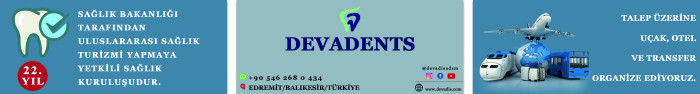 Site Üstü